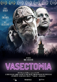 Vasectomia